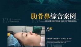 医美爆料事件案例视频,揭秘美容行业潜规则与真实案例